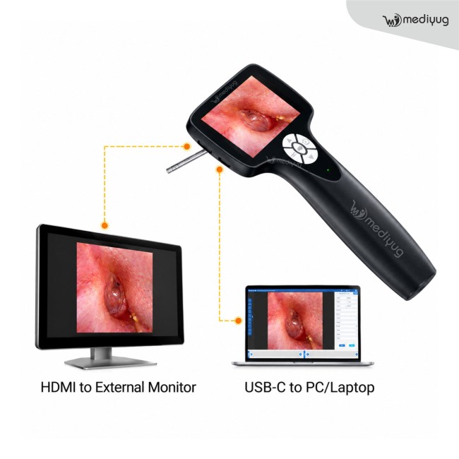Mediyug HD Digital Video Otoscope With 3inch LCD Display | ENT Digital Video Otoscope | PC/Laptop & Android Compatible | MYG-OTO02