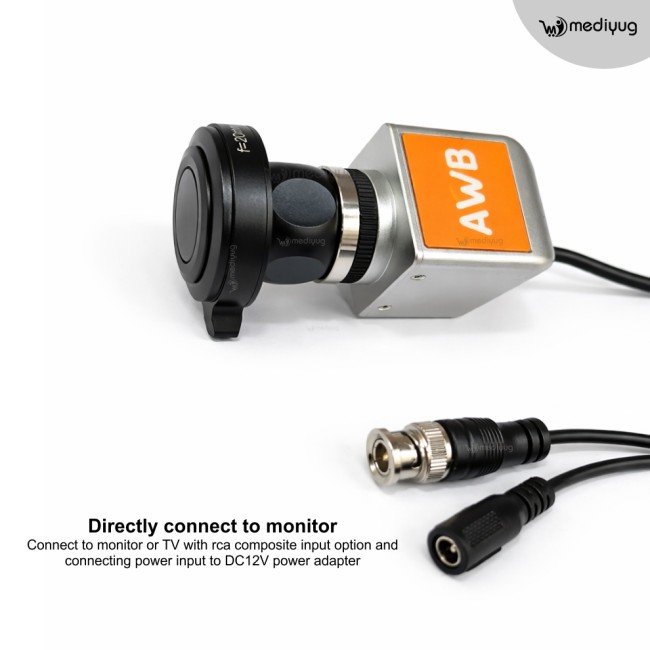 Mediyug Portable ENT Endoscopy Camera System | ENT OPD Endoscopy camera | MYG-MINI ENT Camera