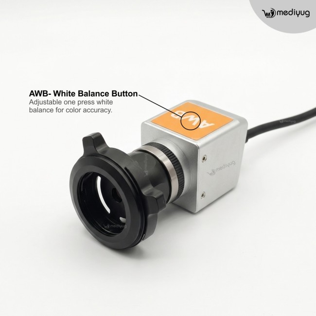 Mediyug Portable ENT Endoscopy Camera System | ENT OPD Endoscopy camera | MYG-MINI ENT Camera