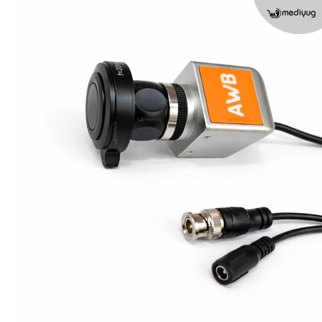 Mediyug Portable ENT Endoscopy Camera System | ENT OPD Endoscopy camera | MYG-MINI ENT Camera