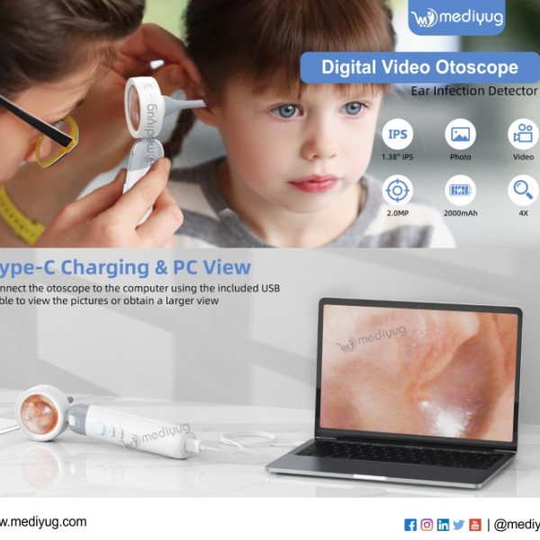Digital Video Otoscope | Screen Video Otoscope for ENT Ear Inpection Camera For Multipurpose Use