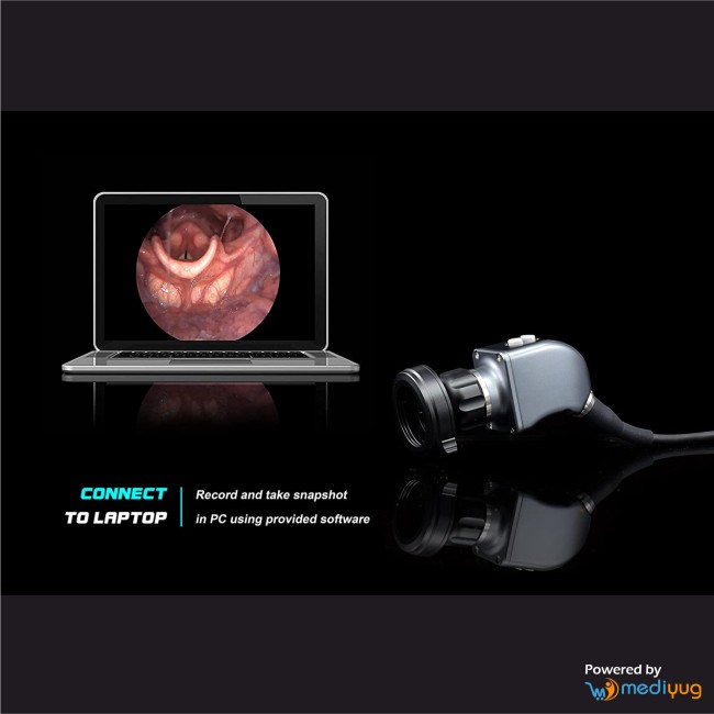 EndoPic HD Endoscopy Camera With Cold LED Light Source