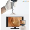 Syncvision Video Otoscope iO1-OTO