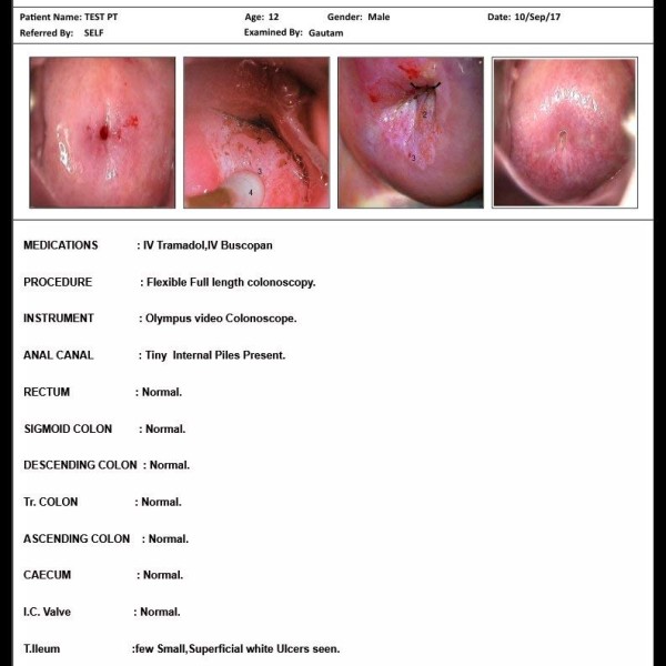 VisualScopy HD- Endoscopy Software (Only Software)